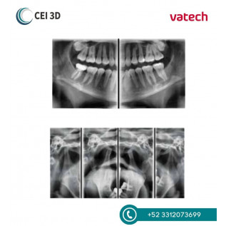 Rayos X Dental Panorámico Digital Pax i SP Vatech