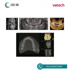 Rayos X Dental Tomógrafo Digital A9 RC Vatech