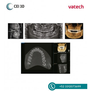 Rayos X Dental Tomógrafo Digital A9 RC Vatech