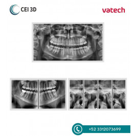 Rayos X Dental Panorámico Digital Pax i Plus Vatech