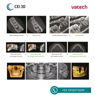 Rayos X Dental Tomógrafo Digital Green X12 RC Vatech
